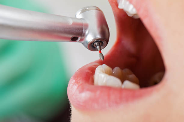 Best Emergency Broken Tooth Repair in Cattaraugus, NY